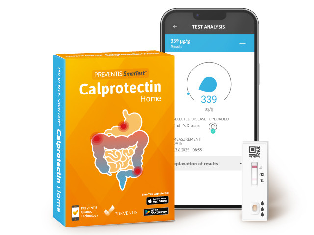 Packaging of the SmarTest Calprotectin Home self-test for people with IBD; next to it, a smartphone with the faecal calprotectin level displayed on the screen and a rapid test cassette.